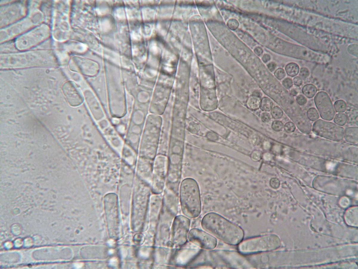 Bacillus thuringiensis